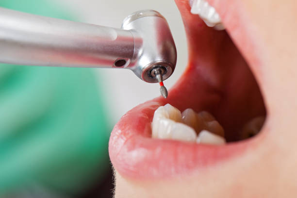 Best Emergency Root Canal Treatment in Connelly Springs, NC
